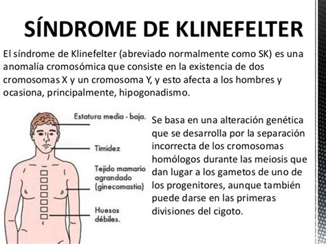 Síndrome de Klinefelter